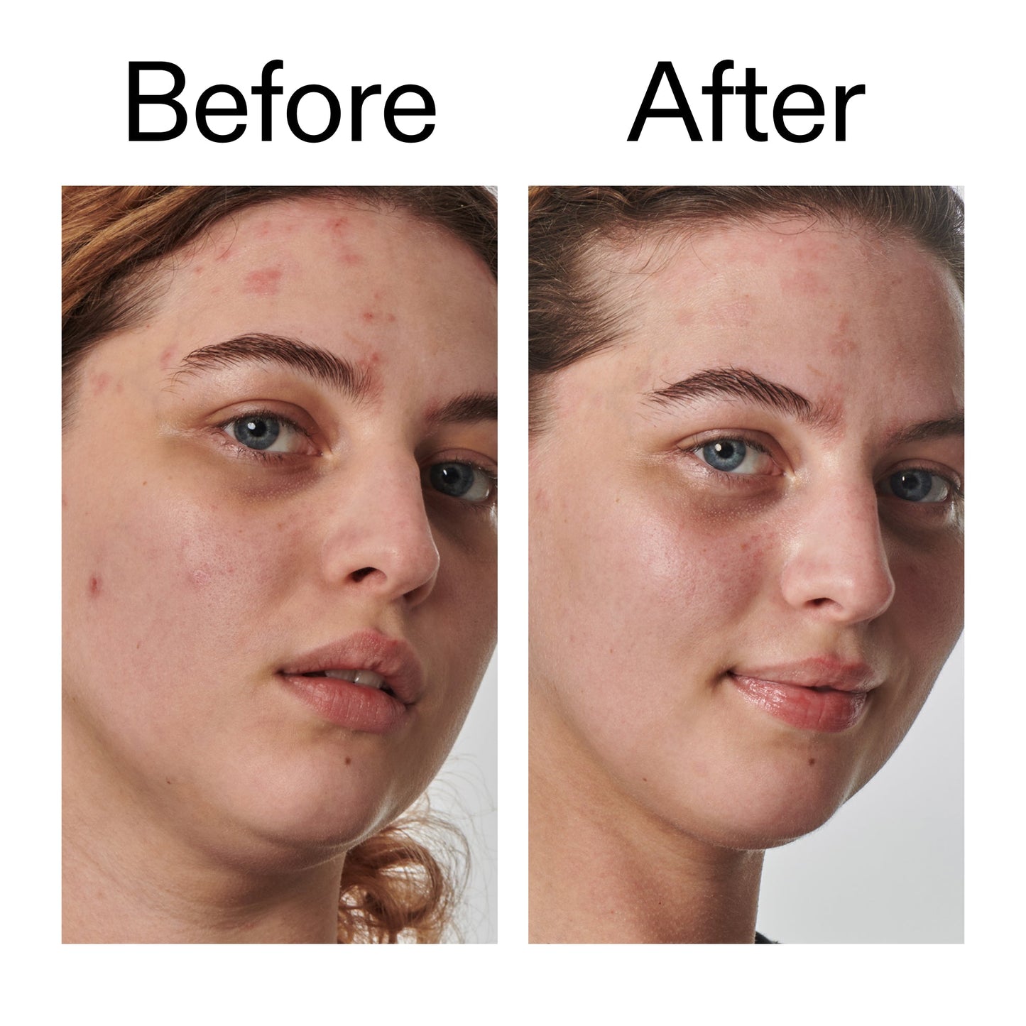10-urea-moisturizer-b7 Dry_and_Rough_Skin_Solution_Before_After_2000x2000_efa6e639-5c39-49bd-a5dd-f0220293120a.jpg