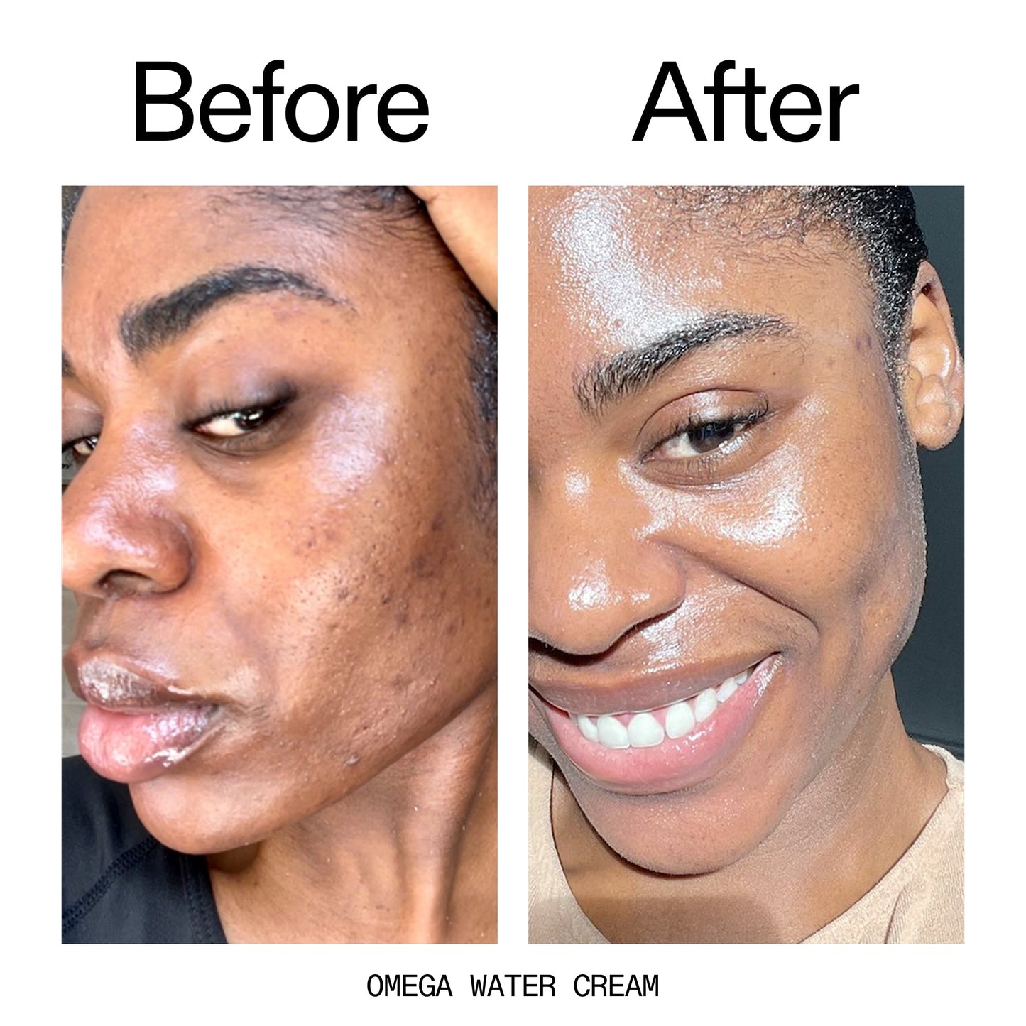 hydrating-cleanser-and-moisturizer-duo-o3 Omega_Water_Cream_Before_After_2000x2000_8e88278b-8c8d-48dc-ac77-4e98ebbd1b77.jpg