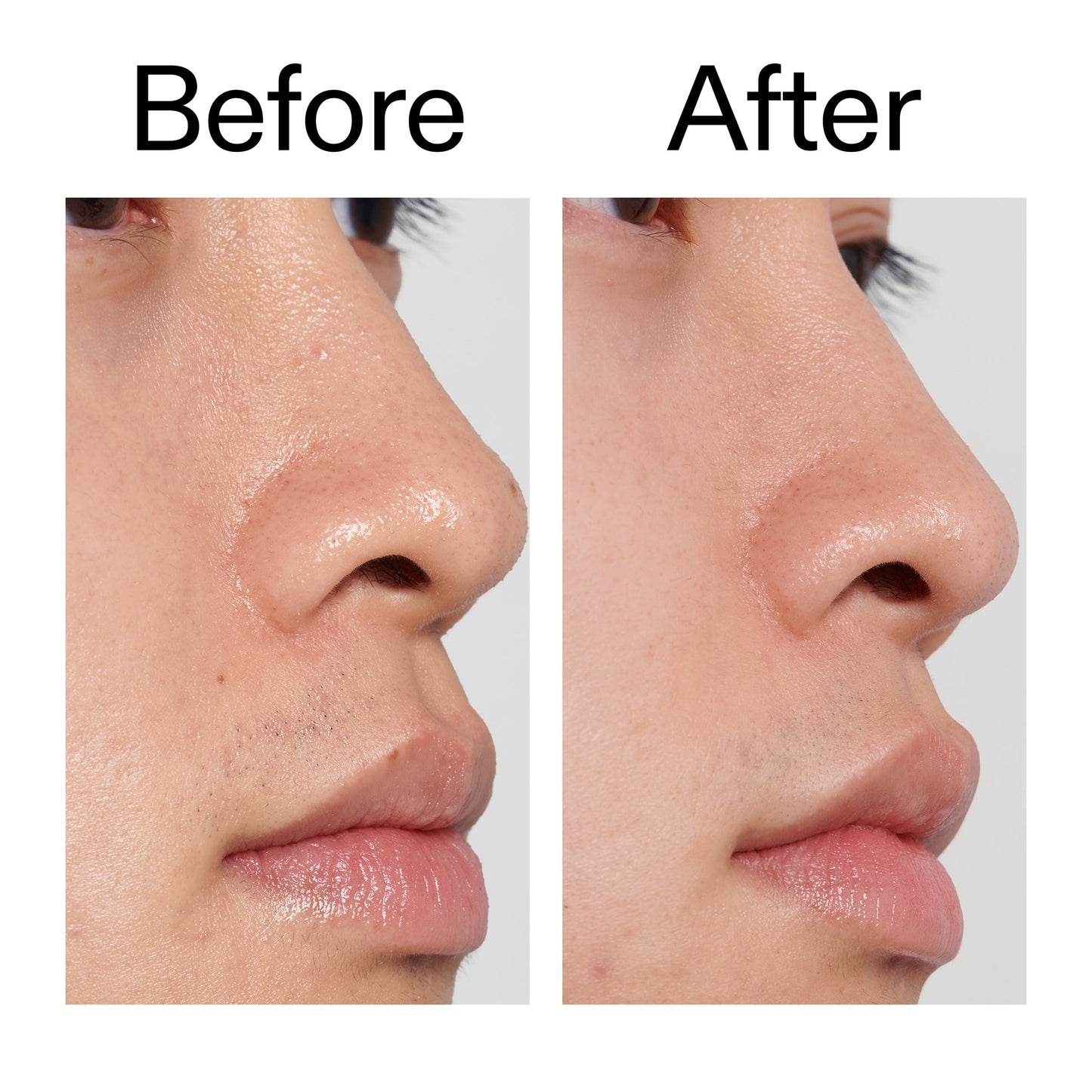 pha-toner-j7 PHA_Toner_Before_After_2000x2000_e3c10172-0150-4342-8b95-57417eaff50d.jpg