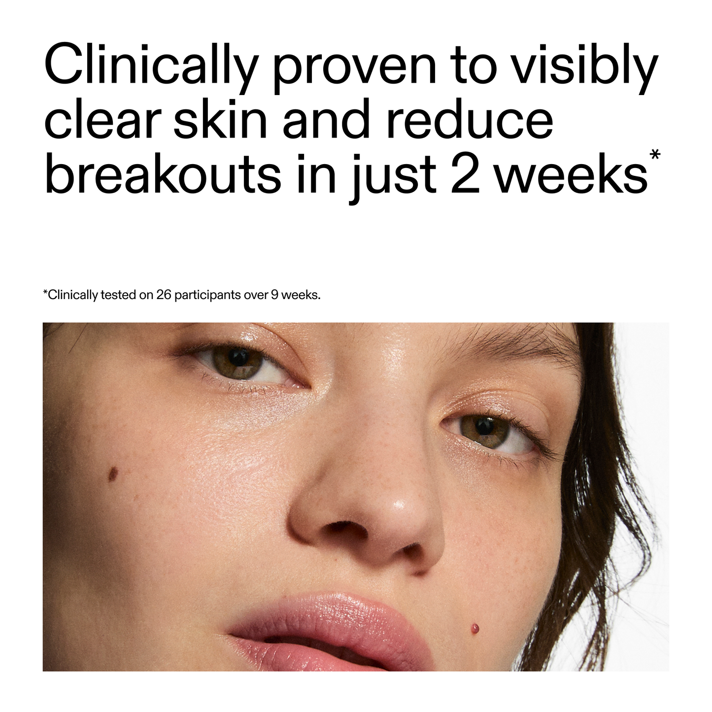 360-acne-clearing-duo-h2 360_Serum_Key_Claim.png