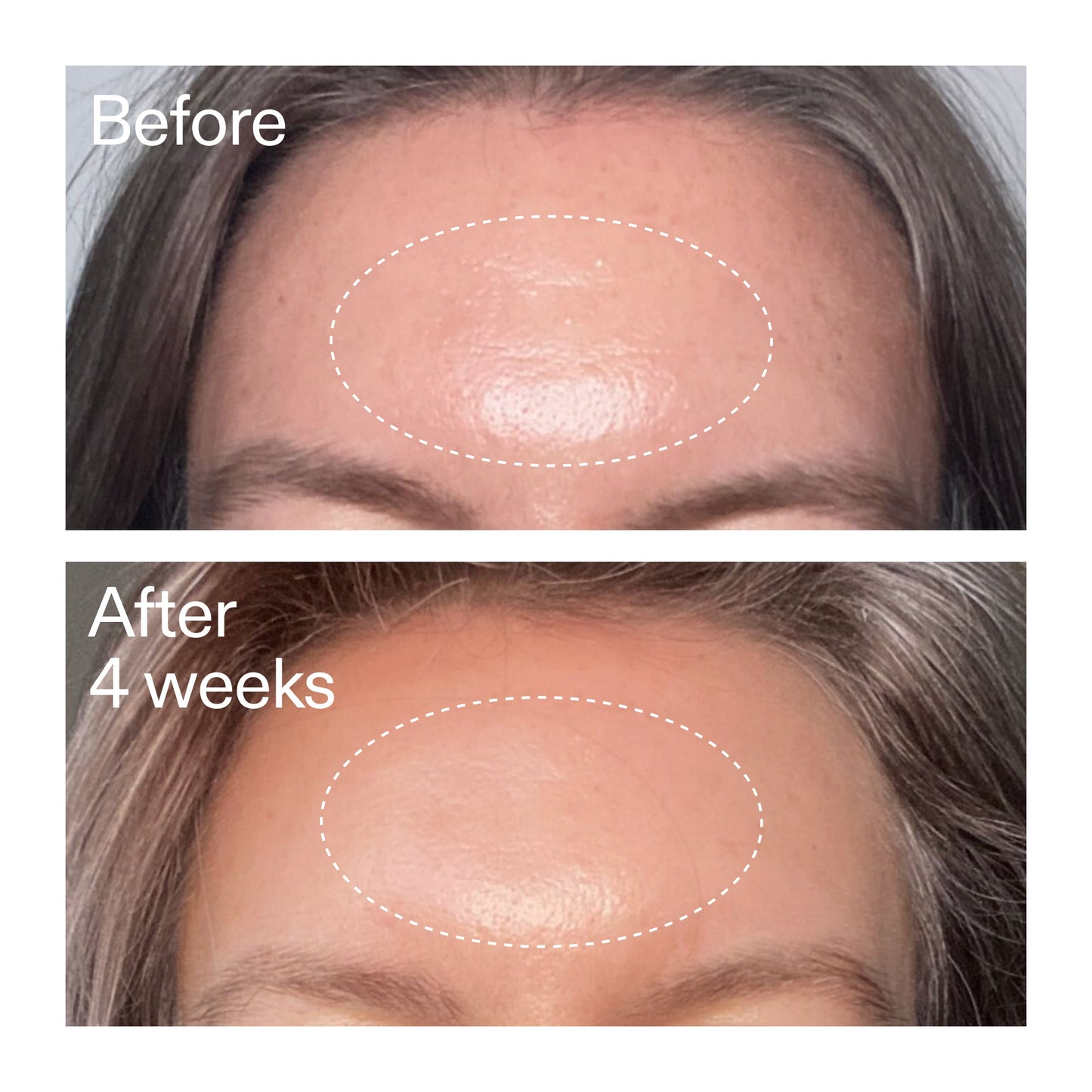 advanced-0-2-retinal-serum-z8 AdvancedRetinal_BeforeAfter1_2000x2000_1da6bb0a-29dd-41d1-95b7-8679696bbf0f.jpg