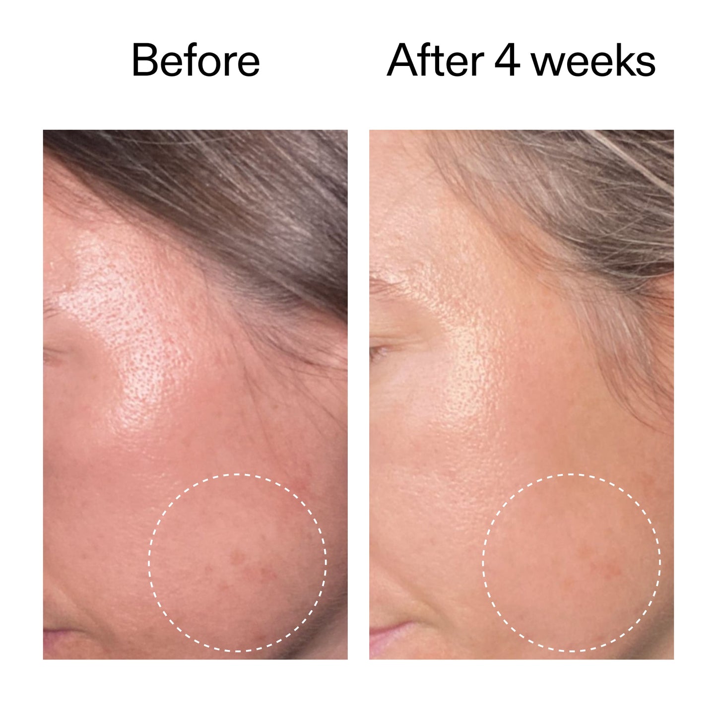advanced-0-2-retinal-serum-duo-p5 AdvancedRetinal_BeforeAfter2__2000x2000_8ef75542-2316-4814-81ee-0f66a85912bc.jpg