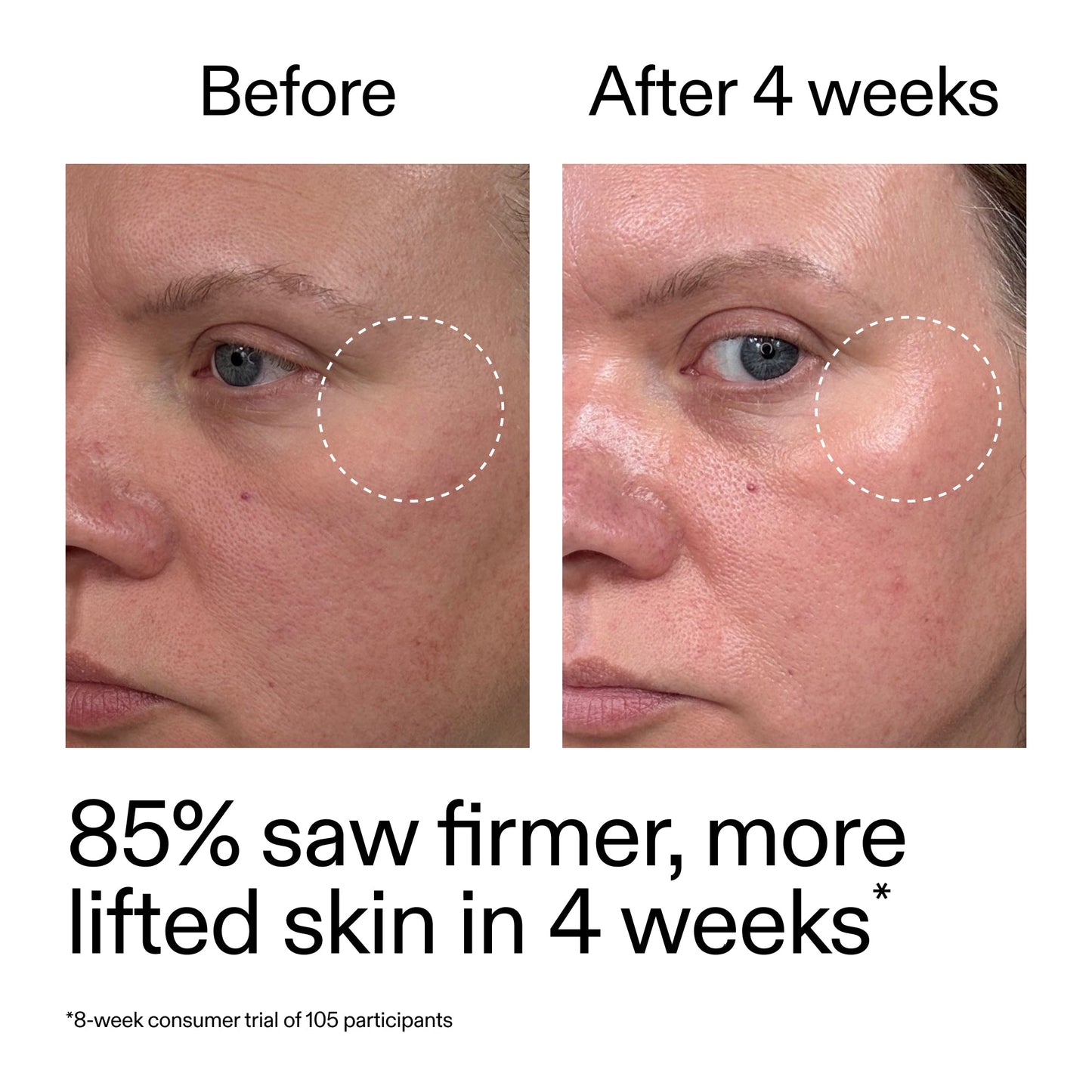 advanced-0-2-retinal-serum-z8 AdvancedRetinal_BeforeAfter_Claim1_2000x2000_bcc385c4-5e73-4f1e-aba8-64267937d0d3.jpg