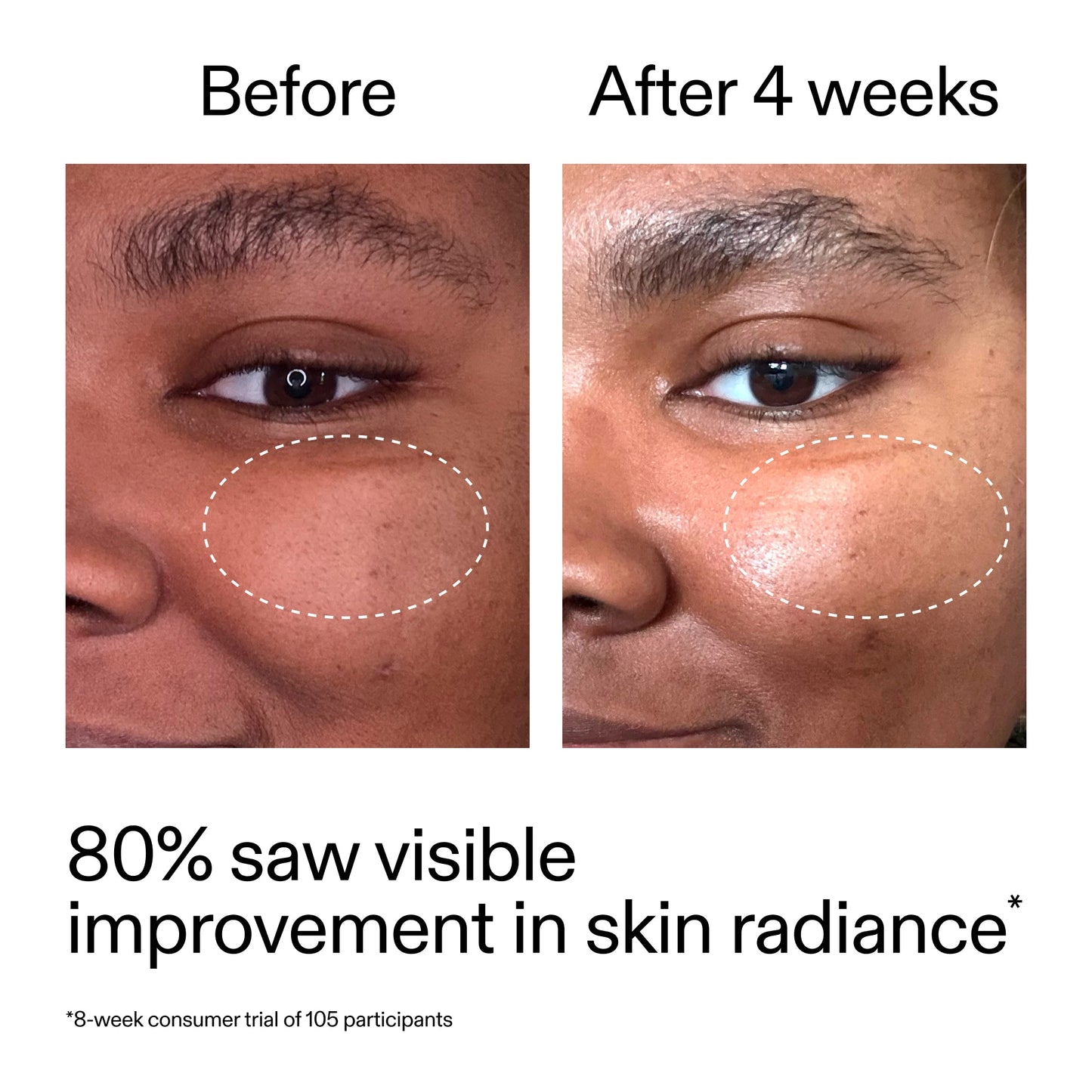 advanced-0-2-retinal-serum-z8 AdvancedRetinal_BeforeAfter_Claim2_2000x2000_39d11e3d-eda9-44ec-ab32-2903b1a368bd.jpg