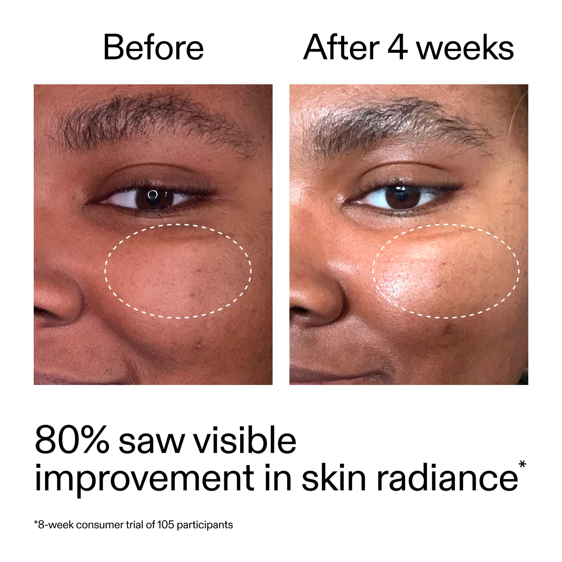 advanced-0-2-retinal-serum-z8 AdvancedRetinal_BeforeAfter_Claim2_2000x2000_39d11e3d-eda9-44ec-ab32-2903b1a368bd.jpg