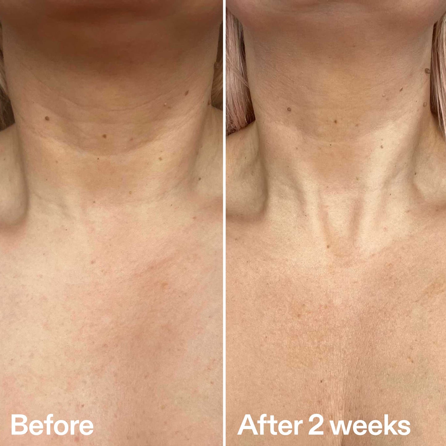 bio-active-neck-lift-stick-s2 B_A_2.jpg