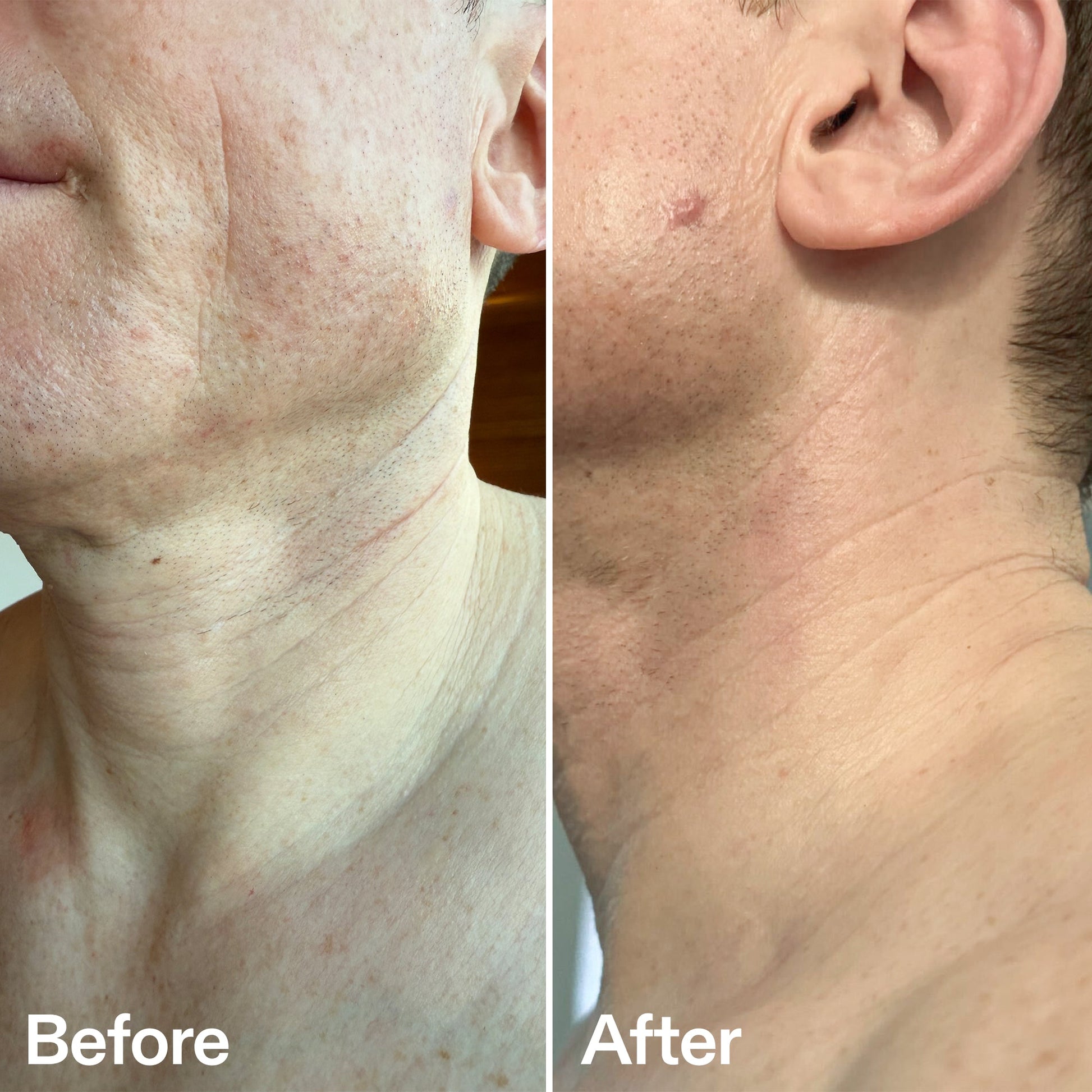 bio-active-neck-lift-stick-s2 B_A_afa2743e-b8e2-4504-92f4-e281cb6cf759.jpg