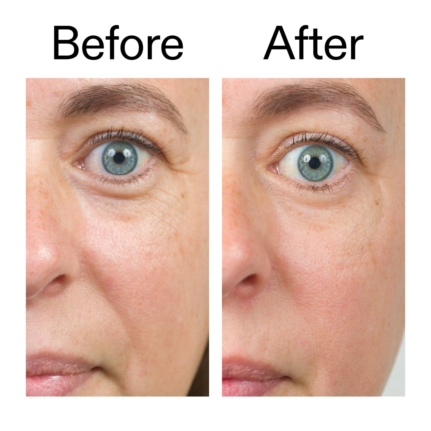 bio-active-ceramide-moisturizer-z8 Bio-Active_Before_After_2000x2000_566e5a9e-135e-417a-8242-b44e5fa35463.jpg
