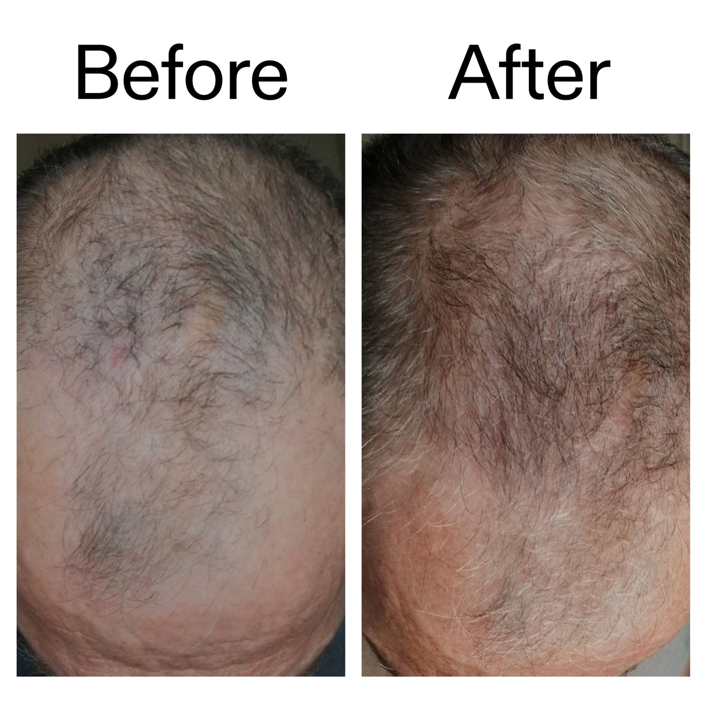3-month-hair-growth-trio-x5 Caffeine_Scalp_Treatment_B_A_Ppage_2000_x_2000.jpg