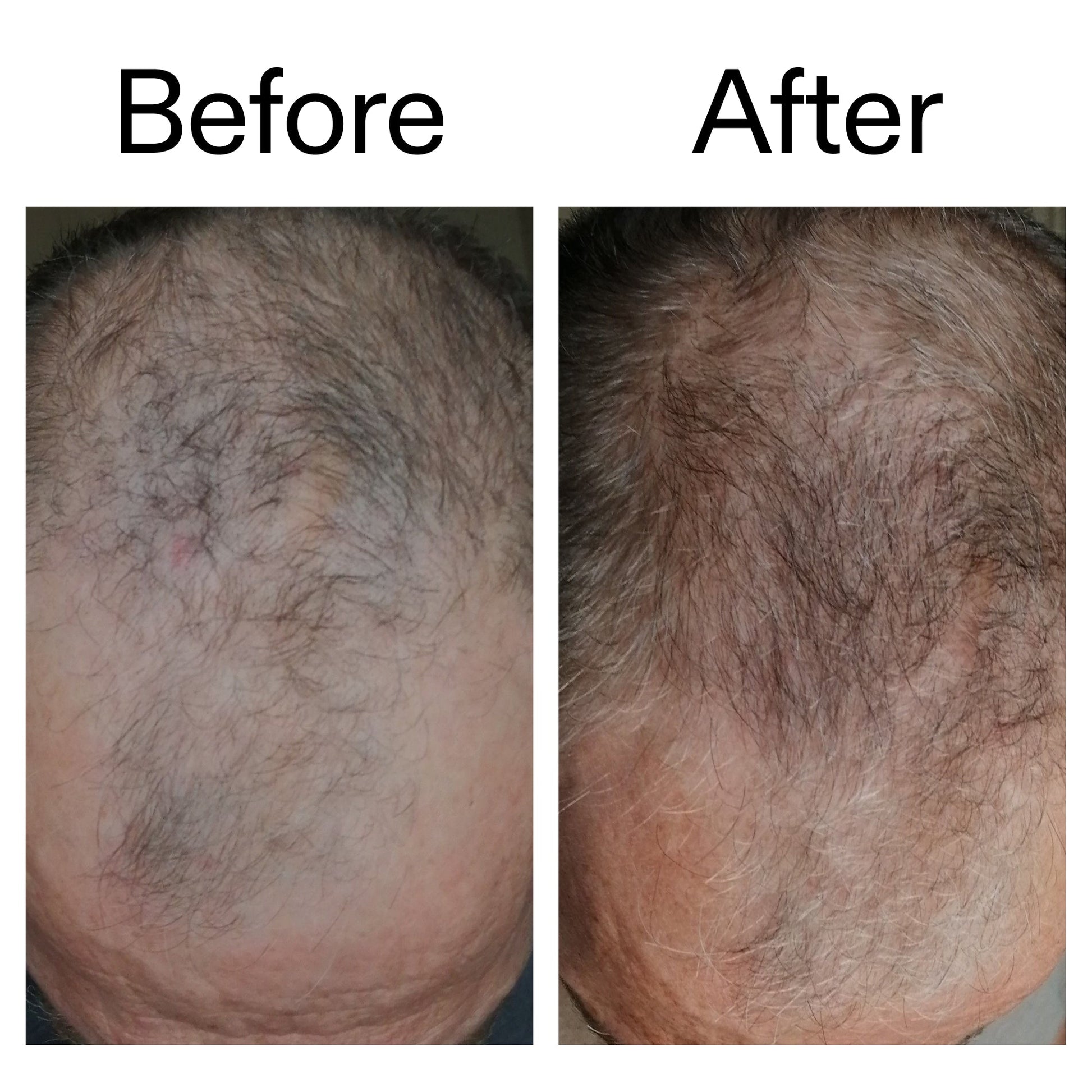 3-month-hair-growth-trio-x5 Caffeine_Scalp_Treatment_B_A_Ppage_2000_x_2000.jpg