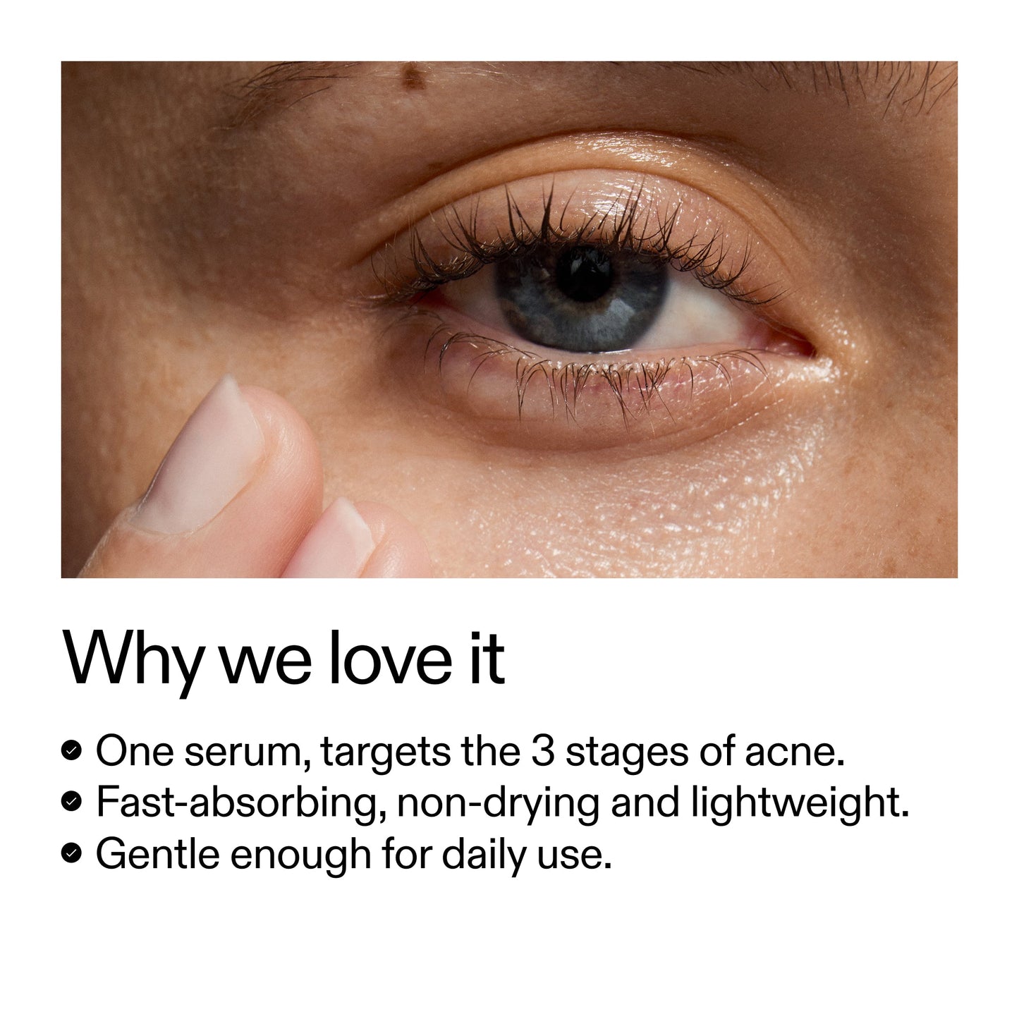 360-acne-clearing-serum-a6 Dioic_Whyweloveit_2000x2000_175aafd3-0cbe-403a-b317-a8362881bfe2.jpg