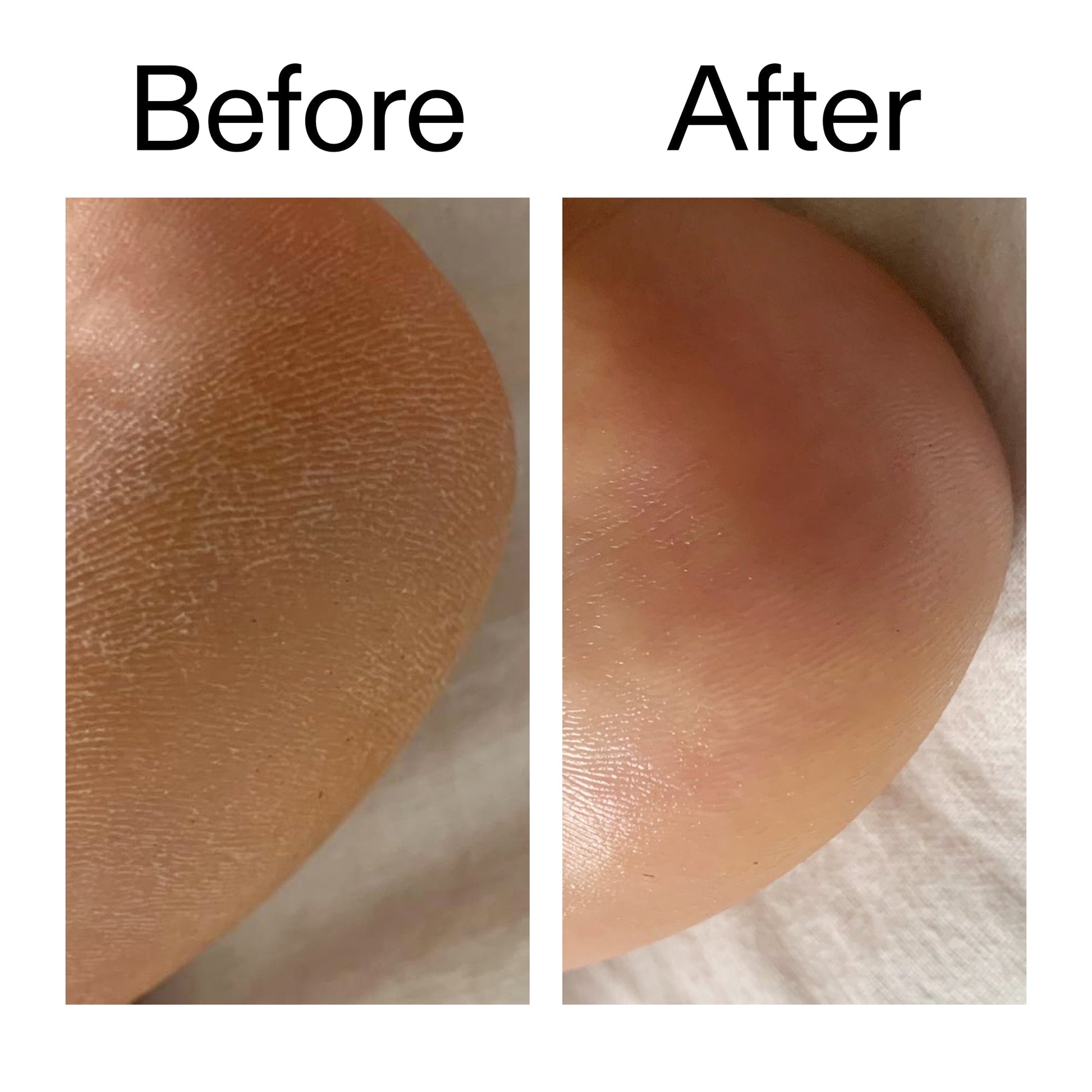 glycolic-acid-exfoliating-body-stick-b7 Glycolic_Acid_Exfoliating_Body_Stick_Before_After_V1_2000x2000_a3043625-9400-429a-a7fb-d6dbd220f722.jpg