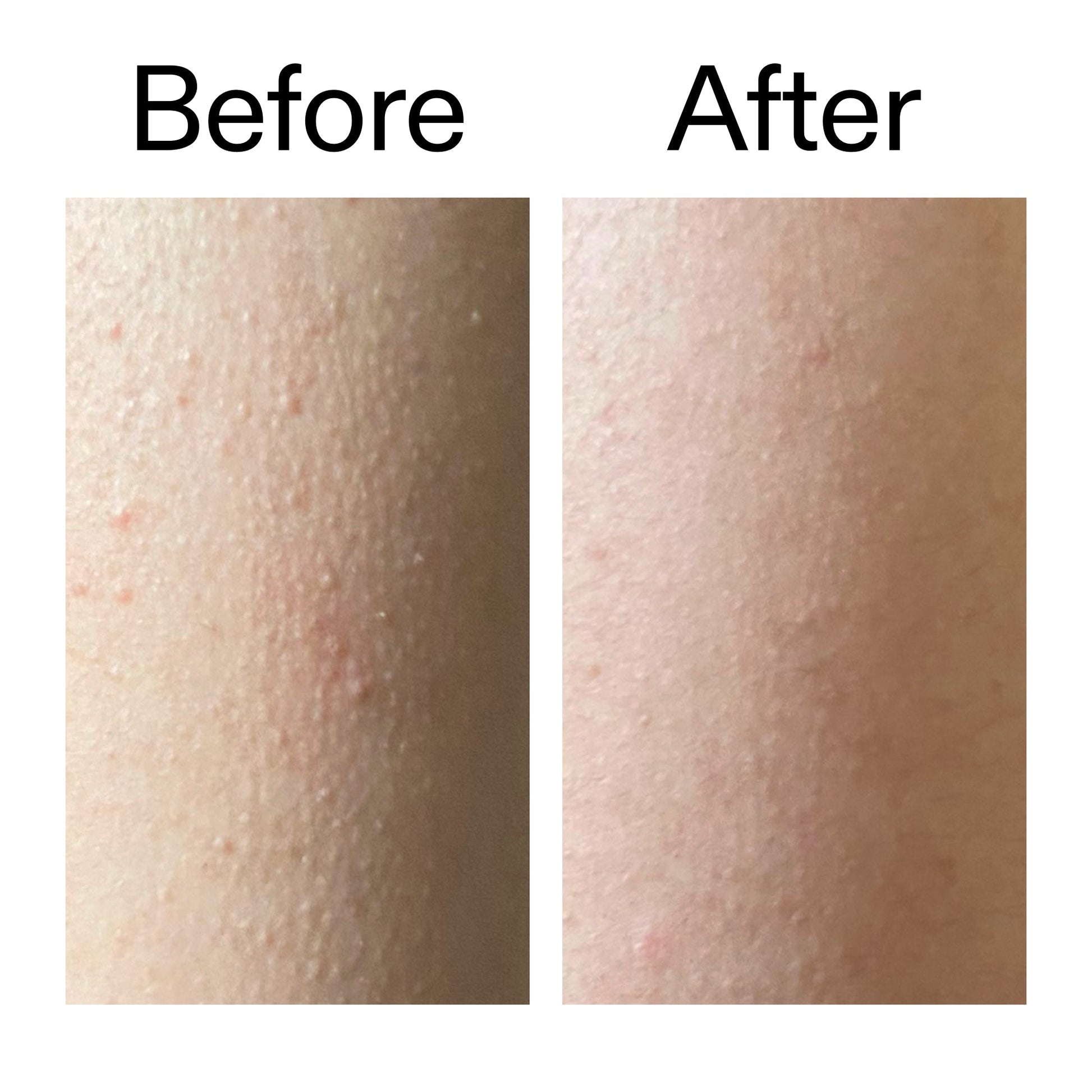 glycolic-acid-exfoliating-body-stick-b7 Glycolic_Acid_Exfoliating_Body_Stick_Before_After_V2_2000x2000_2e4ba052-94f6-4d56-82df-7bdb5b2df7ae.jpg