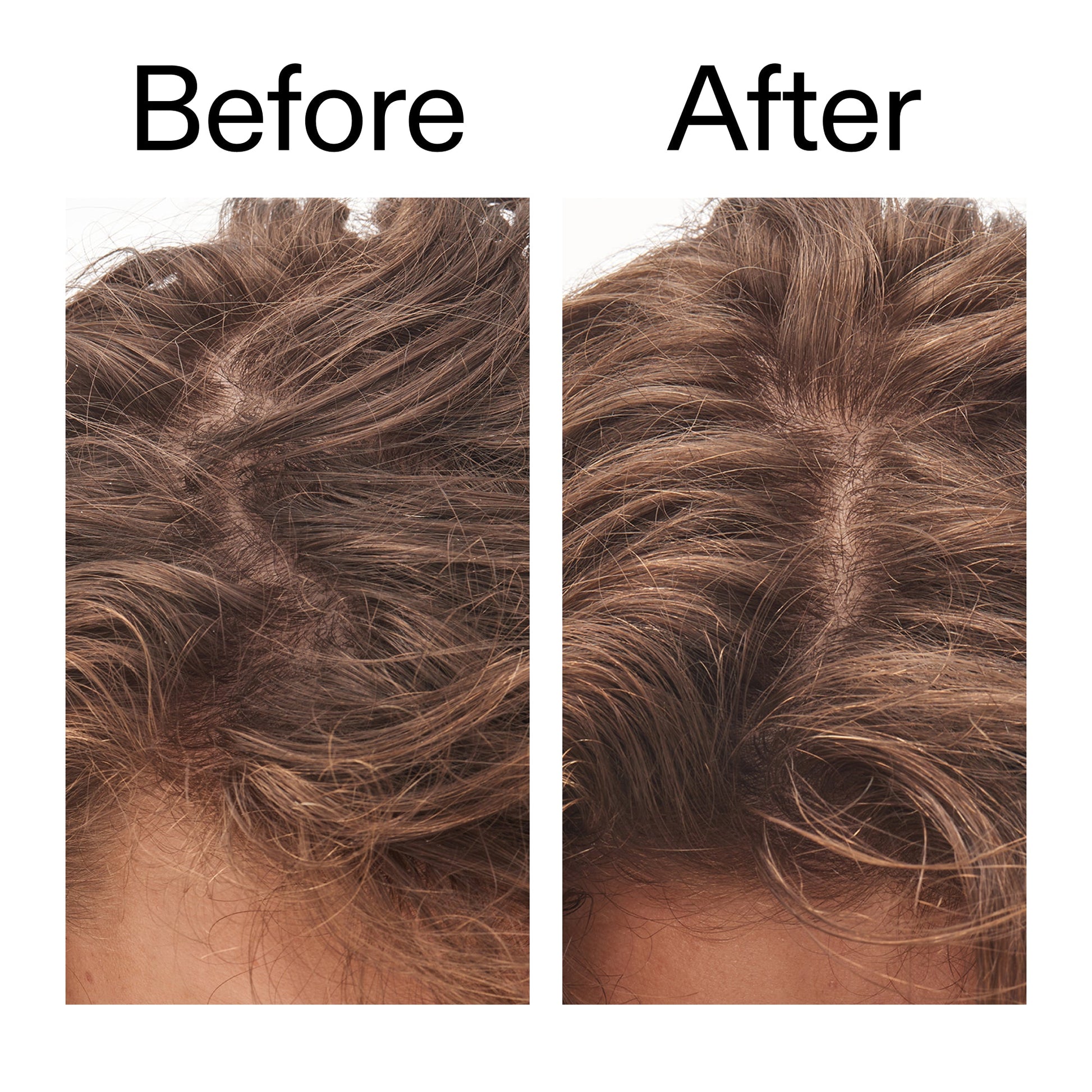 glycolic-acid-exfoliating-scalp-scrub-v1 Glycolic_Acid_Exfoliating_Scalp_Scrub_Before_After_2000x2000_b8561c87-05a1-4caa-80f7-1b6b33d750f7.jpg