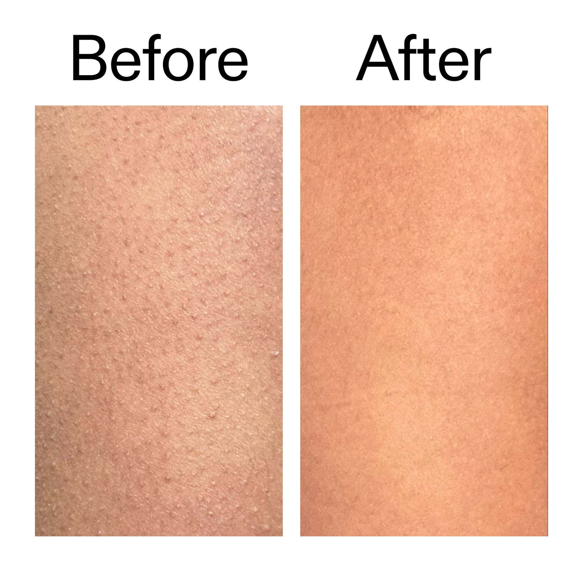 glycolic-acid-exfoliating-body-stick-b7 Glycolic_Body_Stick_B_A_2000x2000_6e6e6b4d-5bd7-43c0-aeed-4d66788e8995.jpg