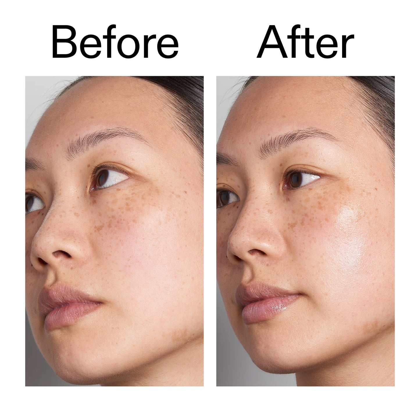 supersize-hyaluronic-acid-serum-100ml-duo-j8 Hyaluronic_Acid_Before_After_2000x2000_d7983956-8aa2-4ea3-8255-c63e8d4f892e.jpg