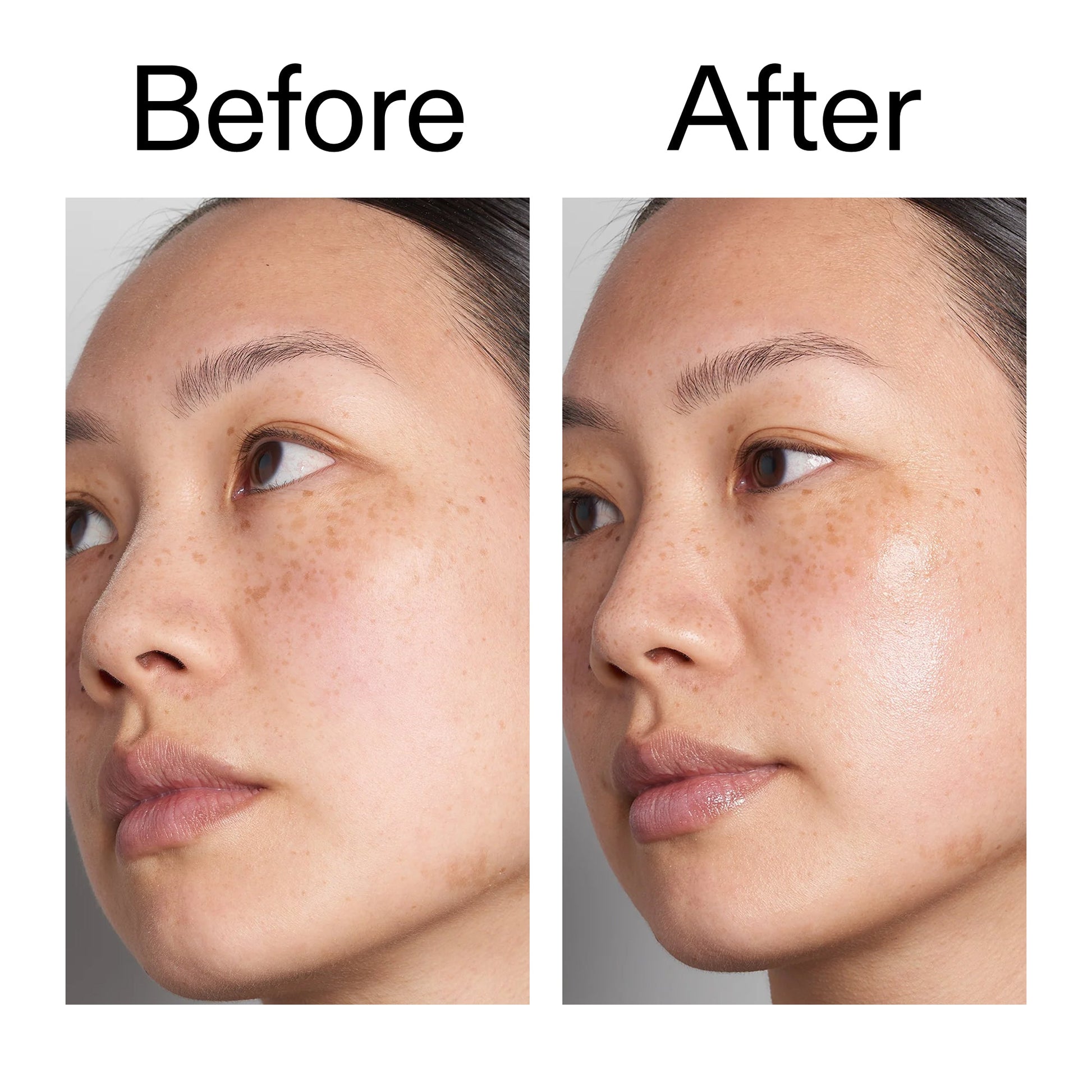 hyaluronic-acid-serum-30ml-m5 Hyaluronic_Acid_Before_After_2000x2000_d7983956-8aa2-4ea3-8255-c63e8d4f892e.jpg