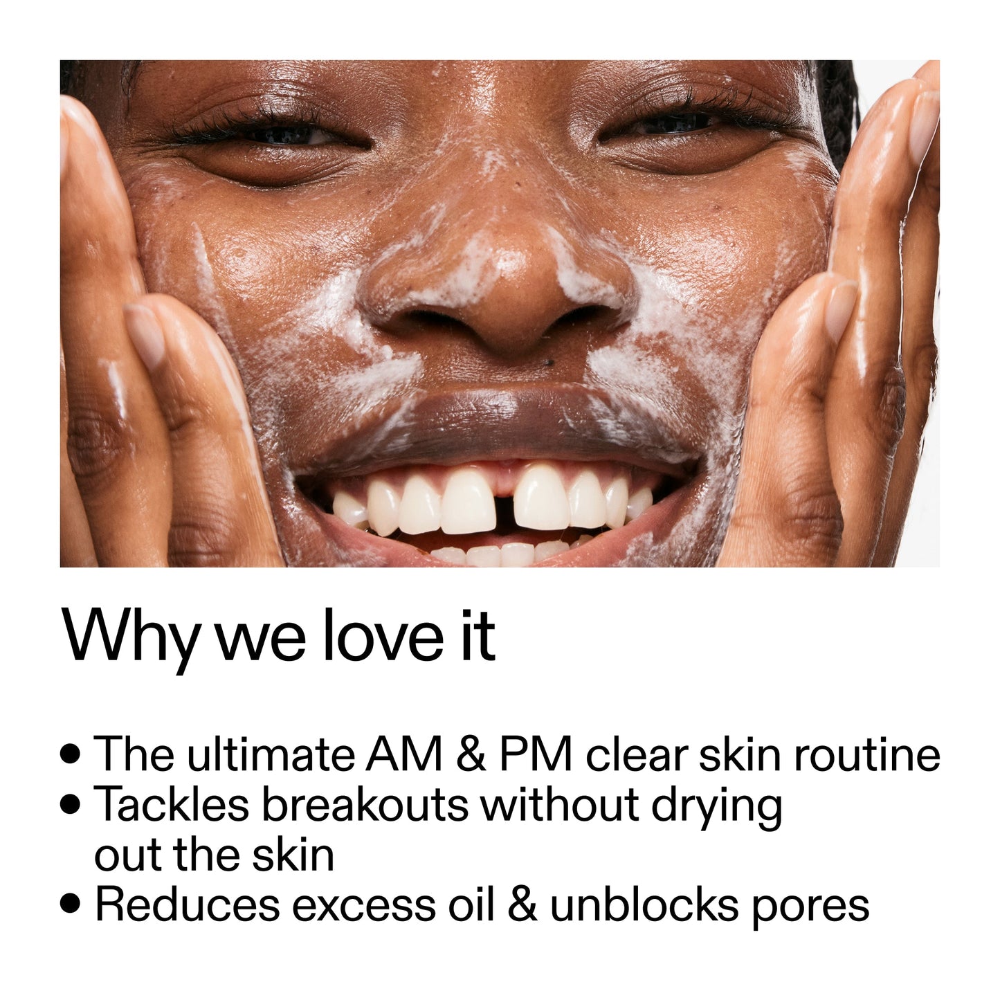 intro-routine-for-acne-l0 Intro_Routine_for_Acne_Why_we_love_it_2000x2000_42499e10-4629-4a0e-a627-7e215f4da6bc.jpg