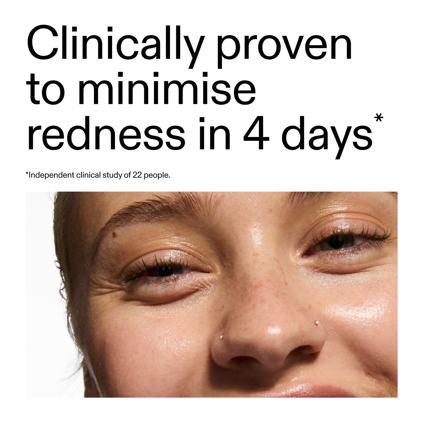 10-azelaic-acid-serum-for-redness-relief-p6 Oat_Cleansing_Balm_Claim_2000x2000_52a841dc-353c-4f2c-8646-3aadb604507d.jpg