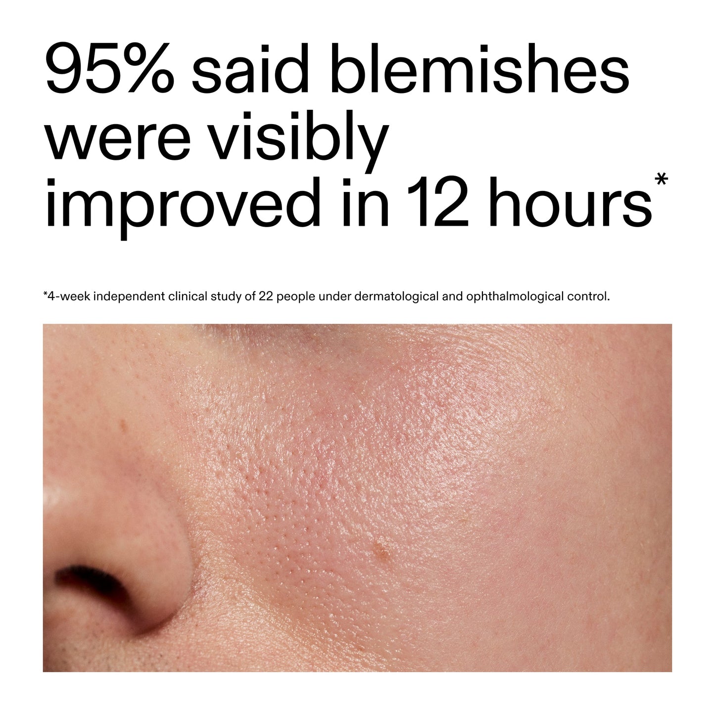 succinic-acid-acne-treatment-x2 Oat_Cleansing_Balm_Claim_2000x2000_ac6ce553-25db-41b2-a981-faae1ac4b8c0.jpg