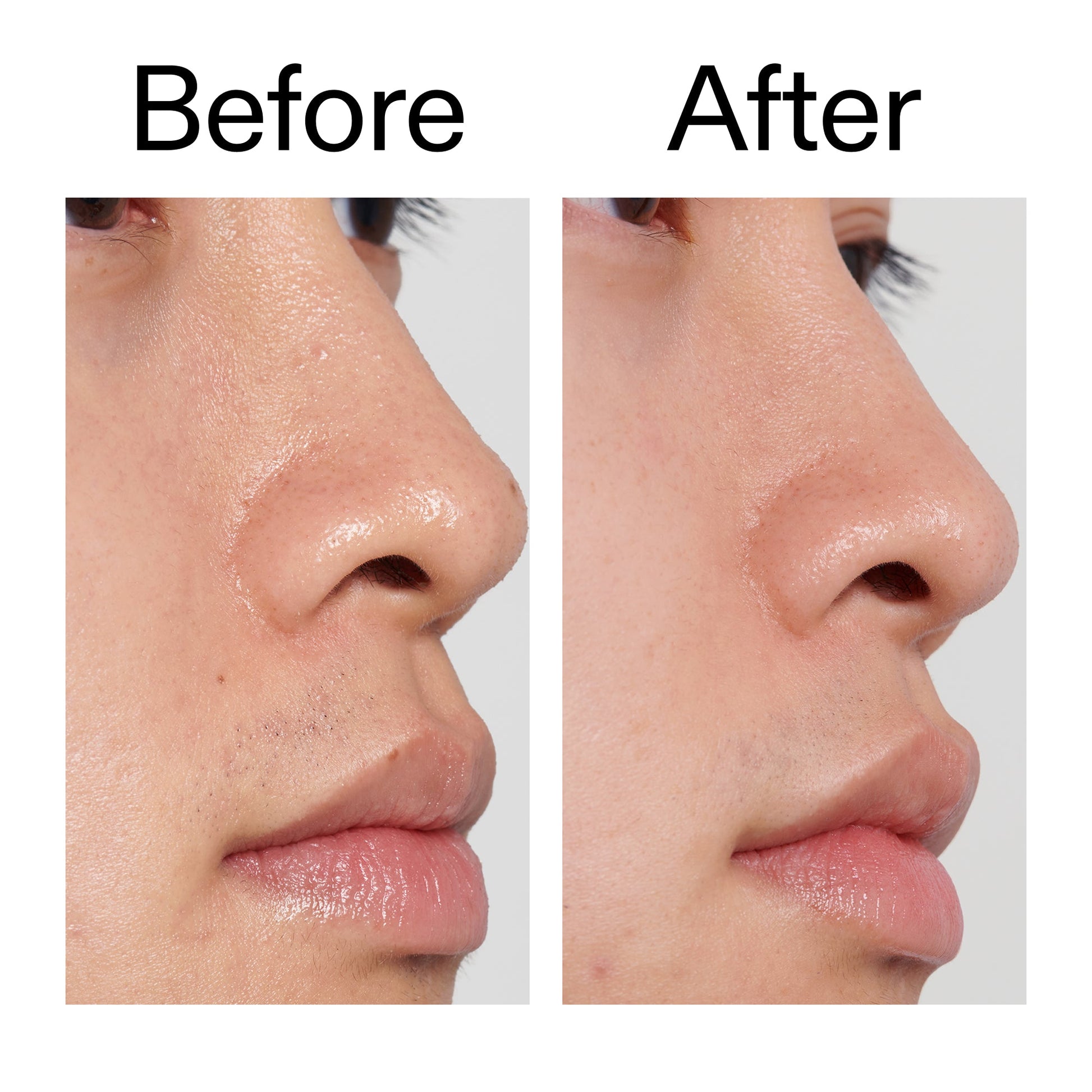 pha-toner-j7 PHA_Toner_Before_After_2000x2000_e3c10172-0150-4342-8b95-57417eaff50d.jpg