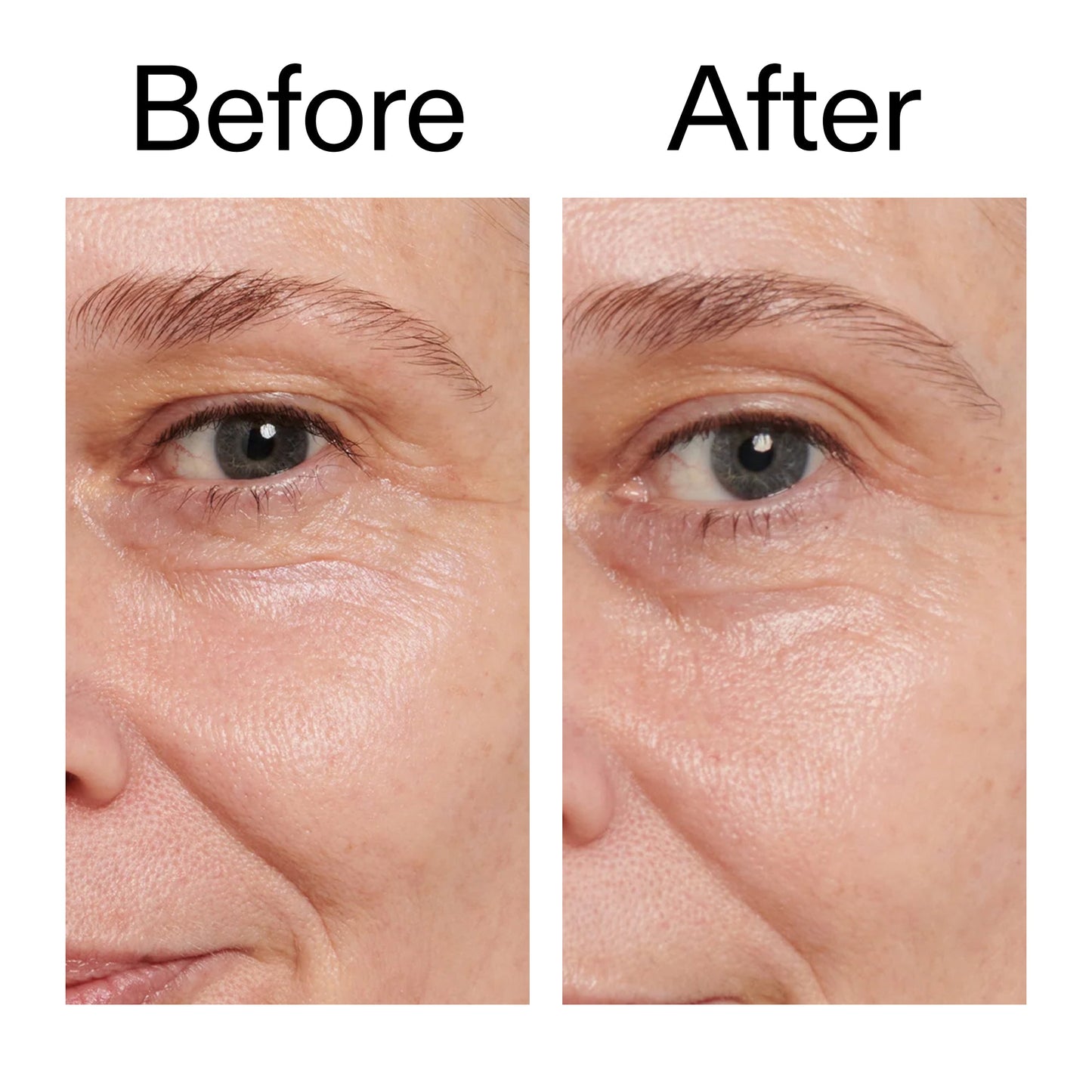 retinol-eye-cream-c5 Retinol_Eye_Cream_Before_After_2000x2000_ac03a80c-109e-4572-a95a-91dc109b4d27.jpg
