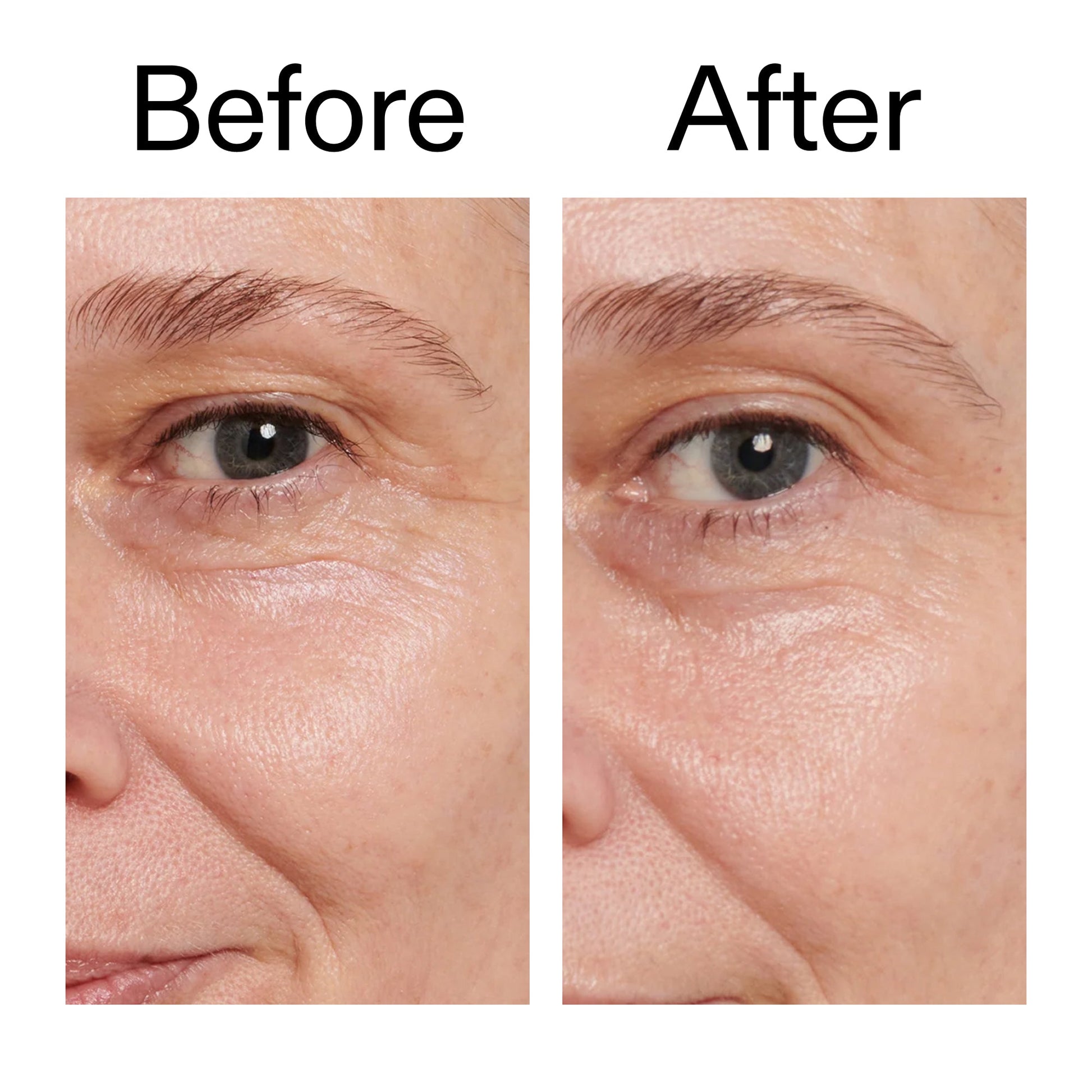 retinol-eye-cream-c5 Retinol_Eye_Cream_Before_After_2000x2000_ac03a80c-109e-4572-a95a-91dc109b4d27.jpg