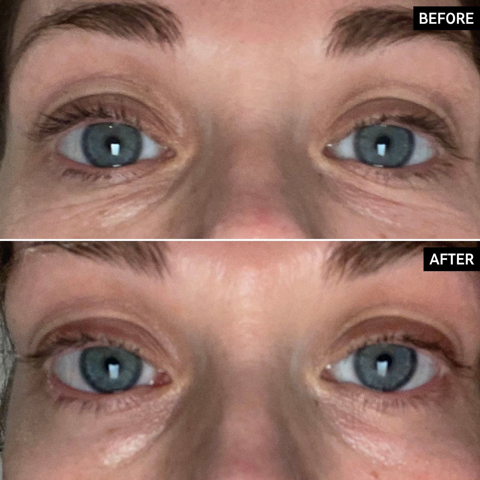 retinol-eye-cream-c5 SITE-UGCBAsApril_Nicole_B_A_PPage_2000x2000_1.jpg