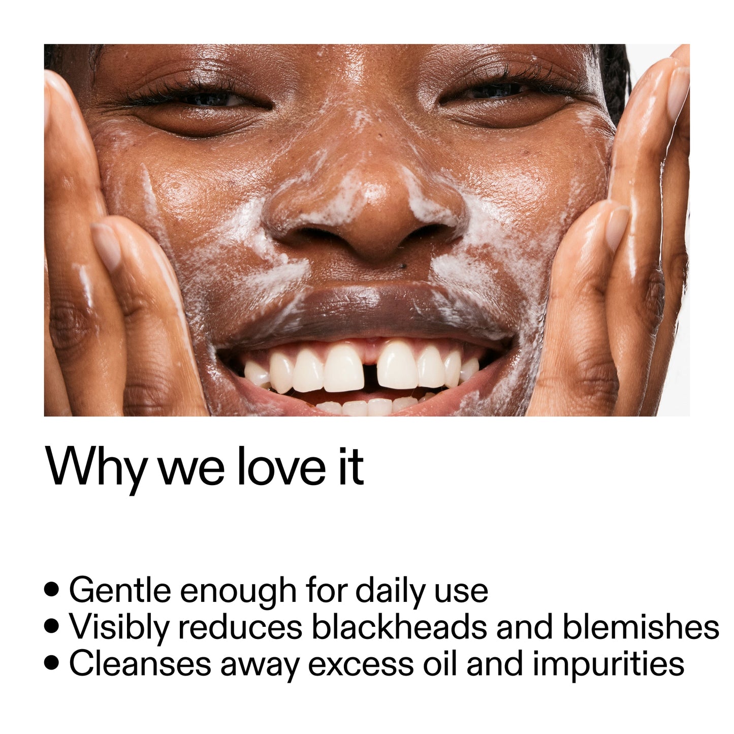 salicylic-acid-cleanser-150ml-z3 Salicylic_Acid_Cleanser_-_300mlWhy_we_love_it_2000x2000_87dc92a9-2559-4309-98cd-4e570f1be735.jpg