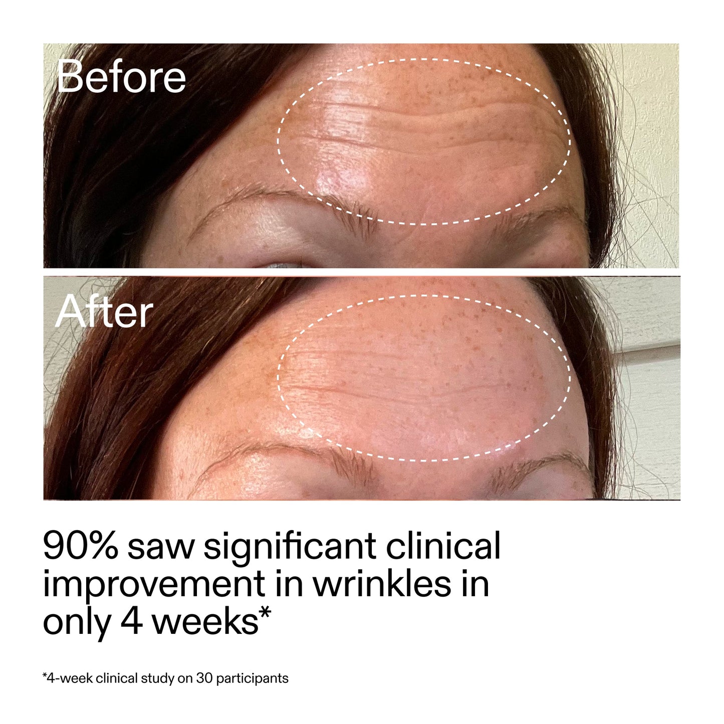 starter-retinol-serum-e9 StarterRetinol_BeforeAfter_Claim1_2000x2000_a09b50b6-4688-4527-abae-21bd142b89b7.jpg