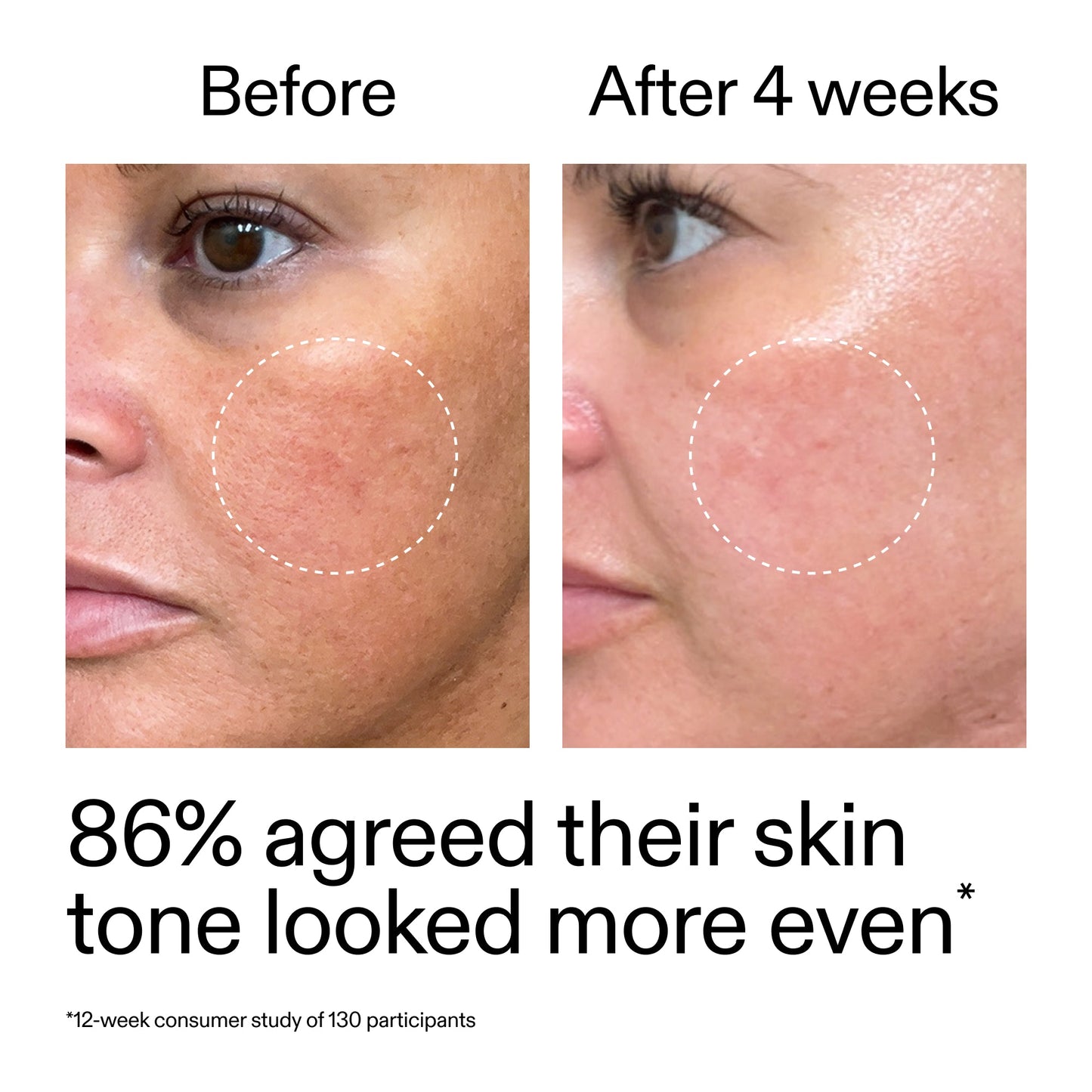 starter-retinol-serum-duo-g5 StarterRetinol_BeforeAfter_Claim2_2000x2000_fc5bb8ac-8588-478f-98d5-28af6651601a.jpg