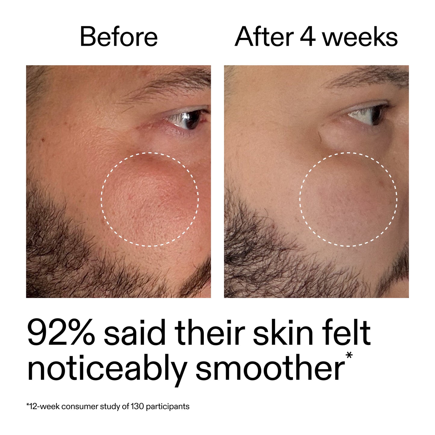 starter-retinol-serum-duo-g5 StarterRetinol_BeforeAfter_Claim3_2000x2000_458243a8-bbb0-4e5d-a274-29c7766d339b.jpg