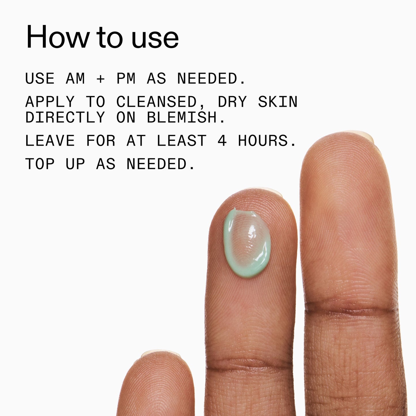 succinic-acid-acne-treatment-x2 Succinic_Acid_Treatment_How_to_Use_2000x2000_d57137d5-d7f1-427c-9a46-5fc00c19c542.jpg