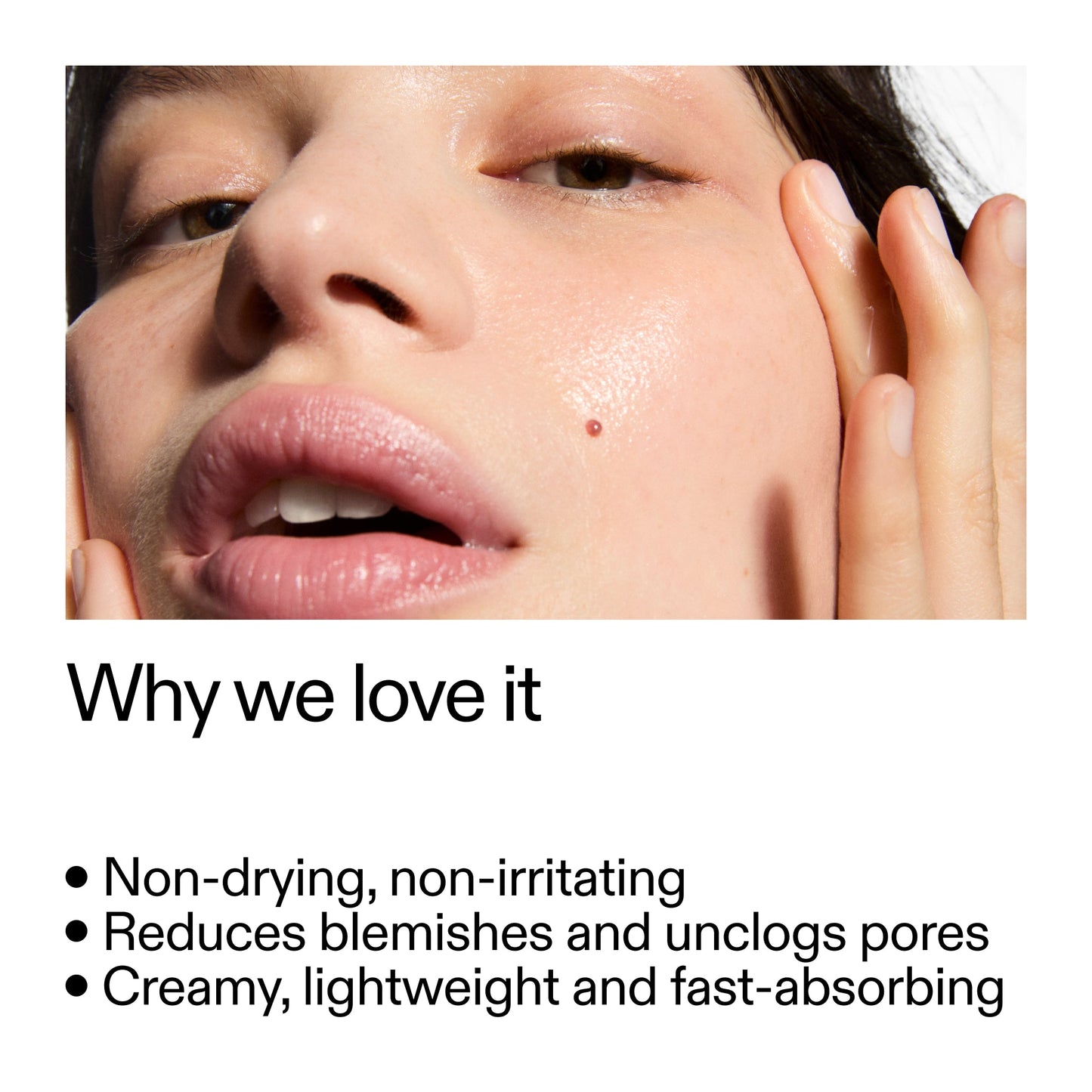succinic-acid-acne-treatment-x2 Succinic_Acid_Treatment_Why_we_love_it_2000x2000_e90dd42a-cfe9-48b5-a2c7-d5eda787a6a8.jpg