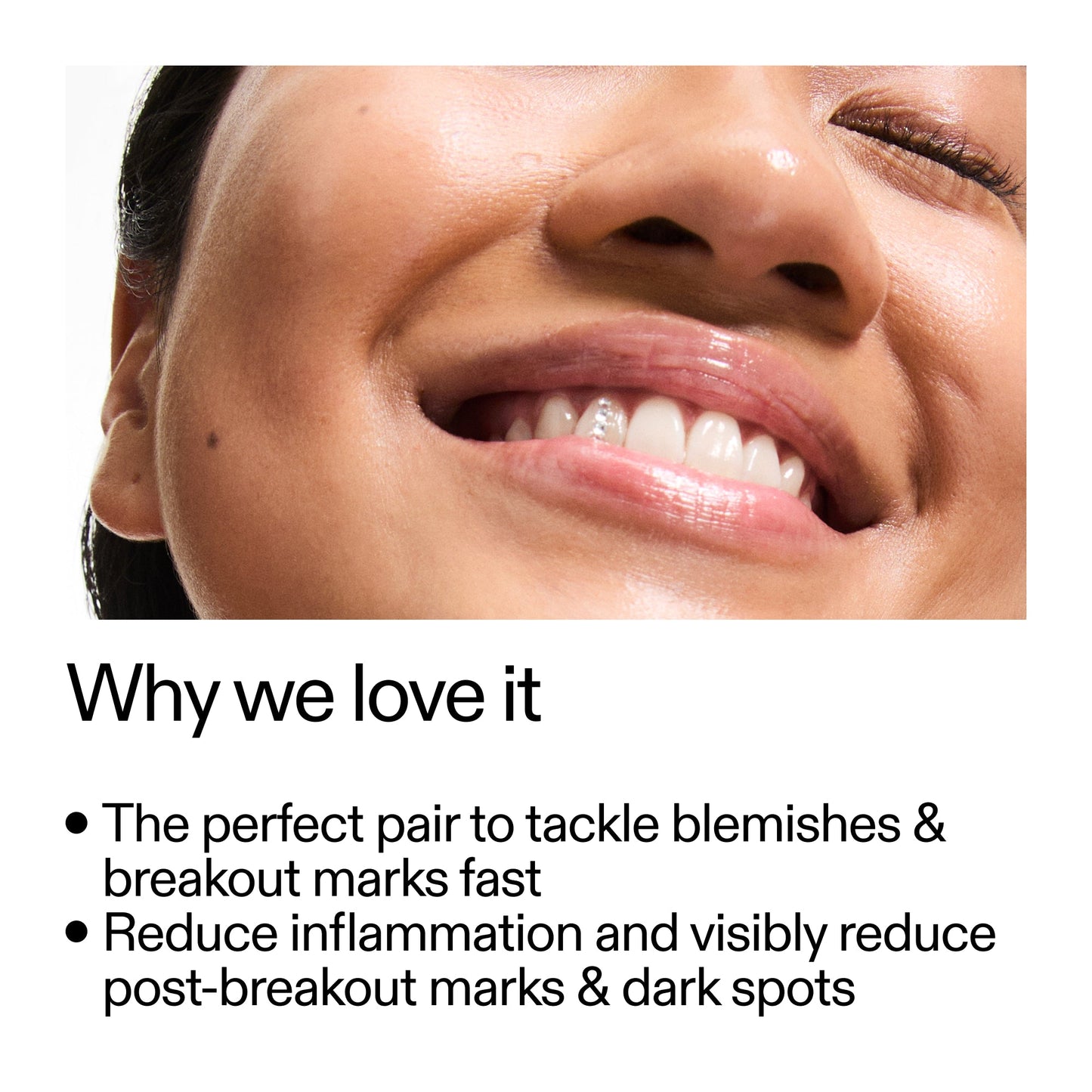 targeted-blemish-duo-j6 Targeted_Blemish_Duo_Why_we_love_it_2000x2000_ff00be46-438b-485f-b5c3-91e60bbb6919.jpg