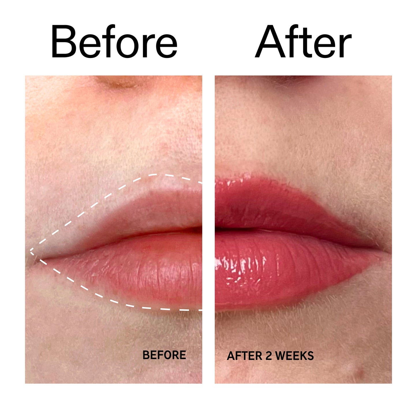 tripeptide-plumping-berry-lip-balm-z0 Tripeptide_Plumping_Lip_Balm_-_Berry_Before_After_2000x2000_9474bbd8-43ca-4b0e-b0e7-dfab70b91927.jpg