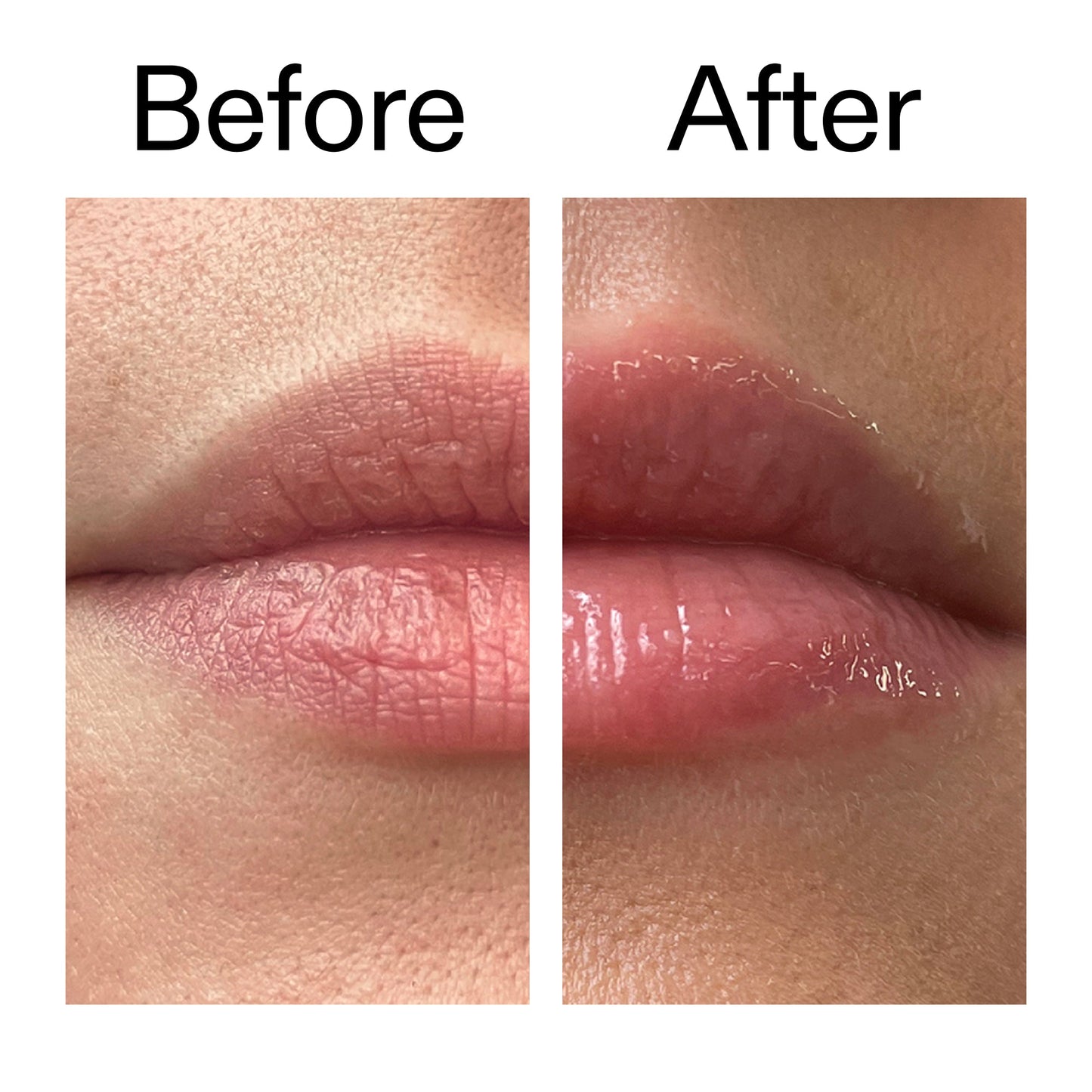 lip-plumping-duo-d5 Tripeptide_Plumping_Lip_Balm_Before_After_2000x2000_b4a5ee04-d2ac-4857-8f01-17209acc4bf3.jpg