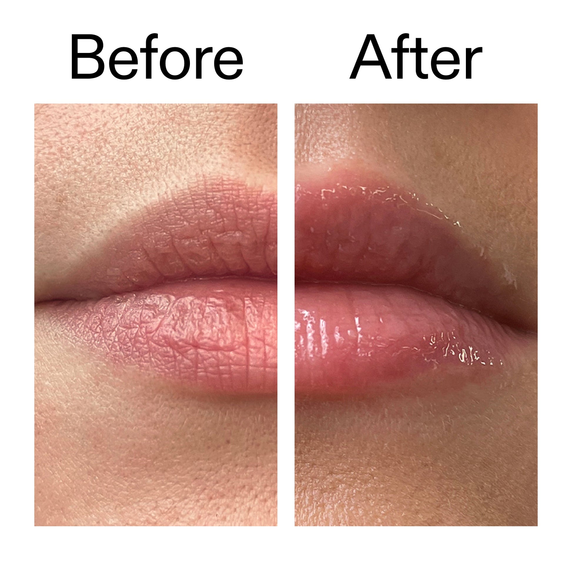 tripeptide-plumping-lip-balm-f5 Tripeptide_Plumping_Lip_Balm_Before_After_2000x2000_b4a5ee04-d2ac-4857-8f01-17209acc4bf3.jpg