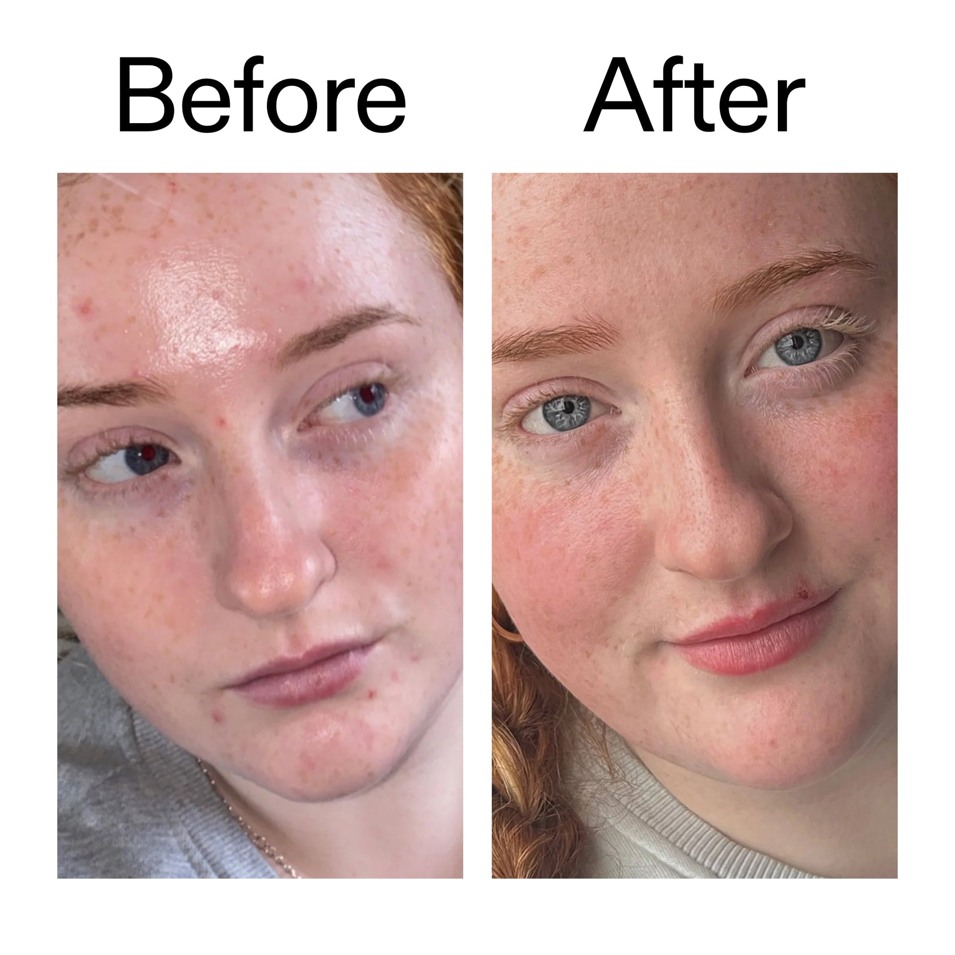 vitamin-b-c-and-e-moisturizer-k7 Vitamin_B_C_and_E_Moisturizer_Before_After_2000x2000_b0781a76-5ad2-4be9-95b8-ef92b356833c.jpg